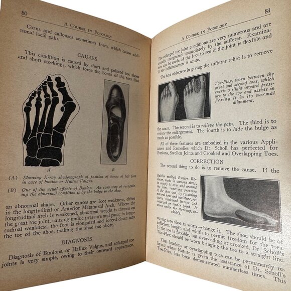 A Course in Podology National School of Podology Illust 1st Edition 1932 HC Book - Picture 10 of 16